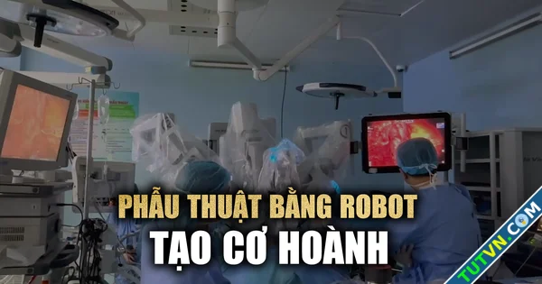 Bệnh viện Bình Dân lần đầu tiên sử dụng robot phẫu thuật ứng dụng trong tạo hình cơ hoành-1.webp