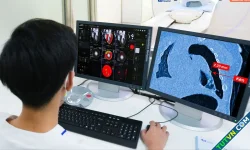 Bé sơ sinh bị vỡ kén khí phổi