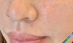 Có nên rửa mặt bằng nước muối?