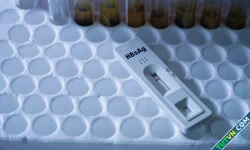Tại sao cần xét nghiệm kháng thể trước khi tiêm vaccine viêm gan B?