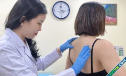 Mụn lưng có thể chữa khỏi không?