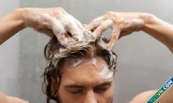 Cách giúp tóc giảm gàu và hết ngứa