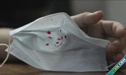 'Virus gây ho ra máu ở Nga có thể là mầm bệnh hô hấp thông thường'