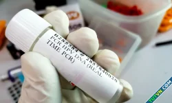 Ai có nguy cơ nhiễm HPV-1.webp