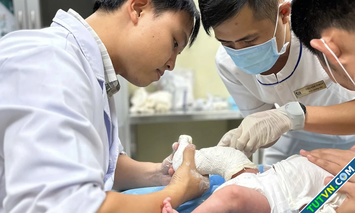 Dị tật bàn chân khoèo ở trẻ em-1.webp